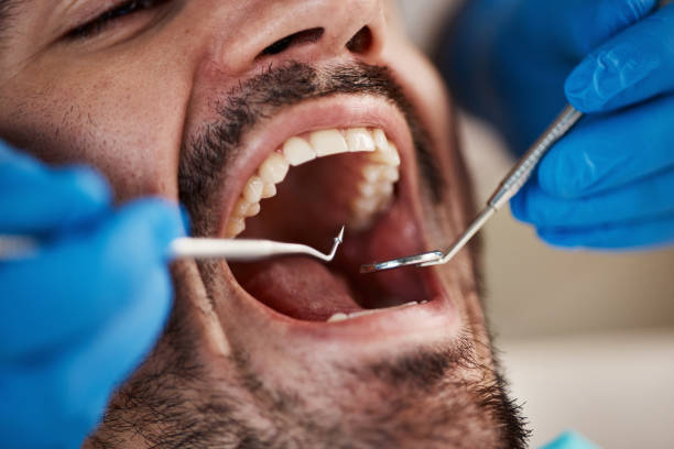 Best Dentist for Tooth Abscess  in Euless, TX